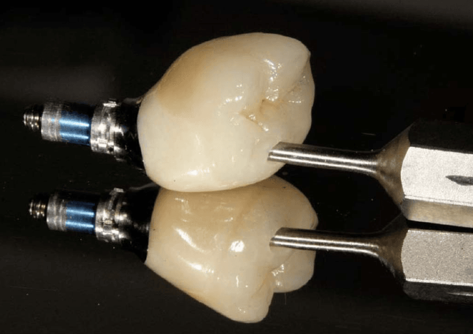 Prothetische Zahnmedizin