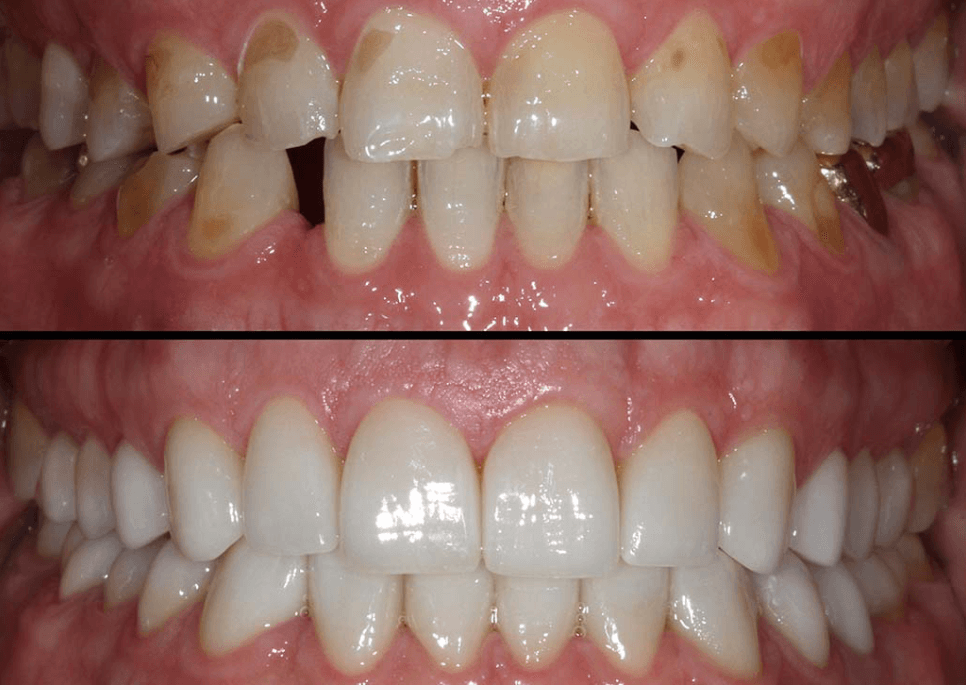 VDO Dental Fortbildung (Englisch)
