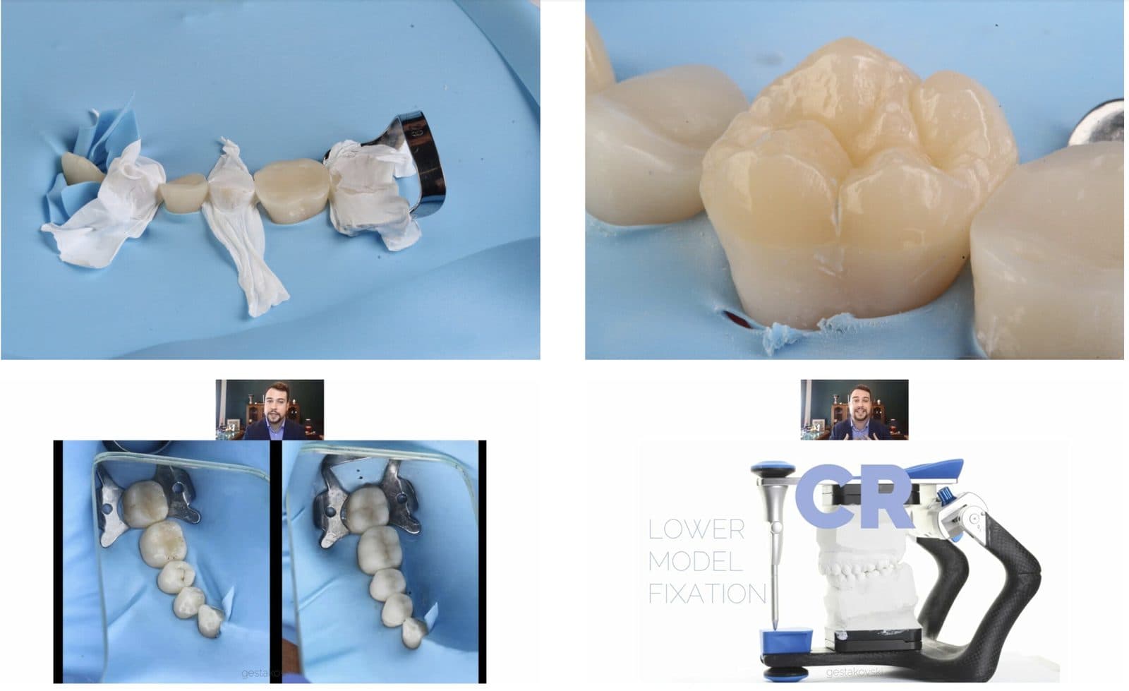 Flowable Injection Posteriors Hands-On Kurs