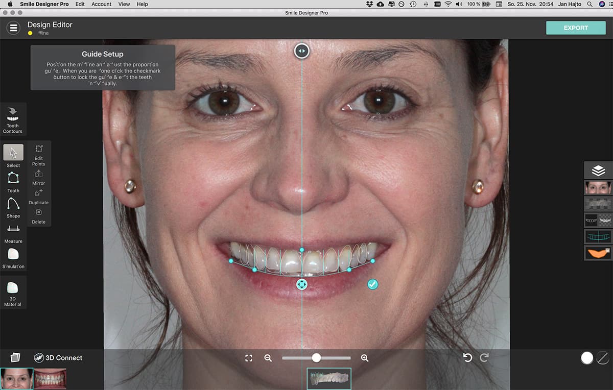 Digital Smile Design