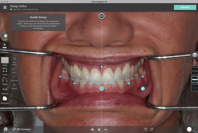 Neue Zähne Die Gesamtsanierung Dental Team Dr. Hajtó München