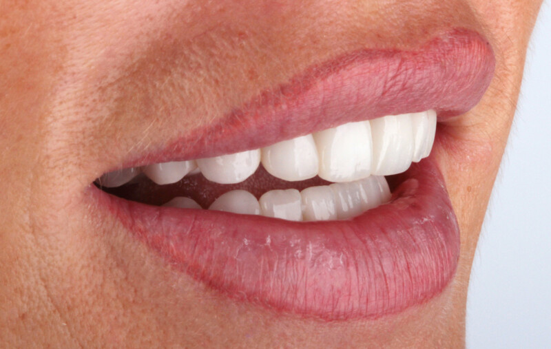 Publikationen von Zahnarzt Dr. Jan Hajtó - Dr. Jan Hajtó, München