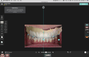 Smile Design Interorale Aufnahme und 3D Scan