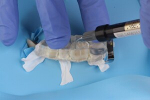 Injectable Technique – Composite Tabletops in Distal Teeth by David Geštakovski