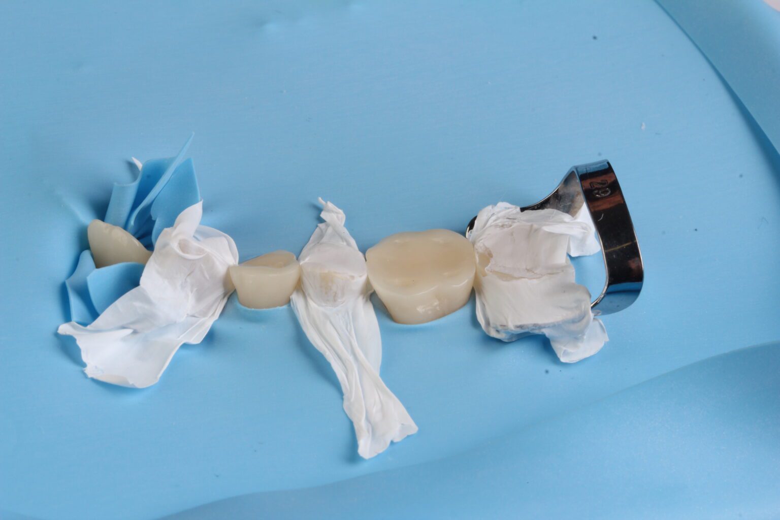 Course Contents 2 - Injectable Technique – Composite Tabletops in Distal Teeth by David Geštakovski