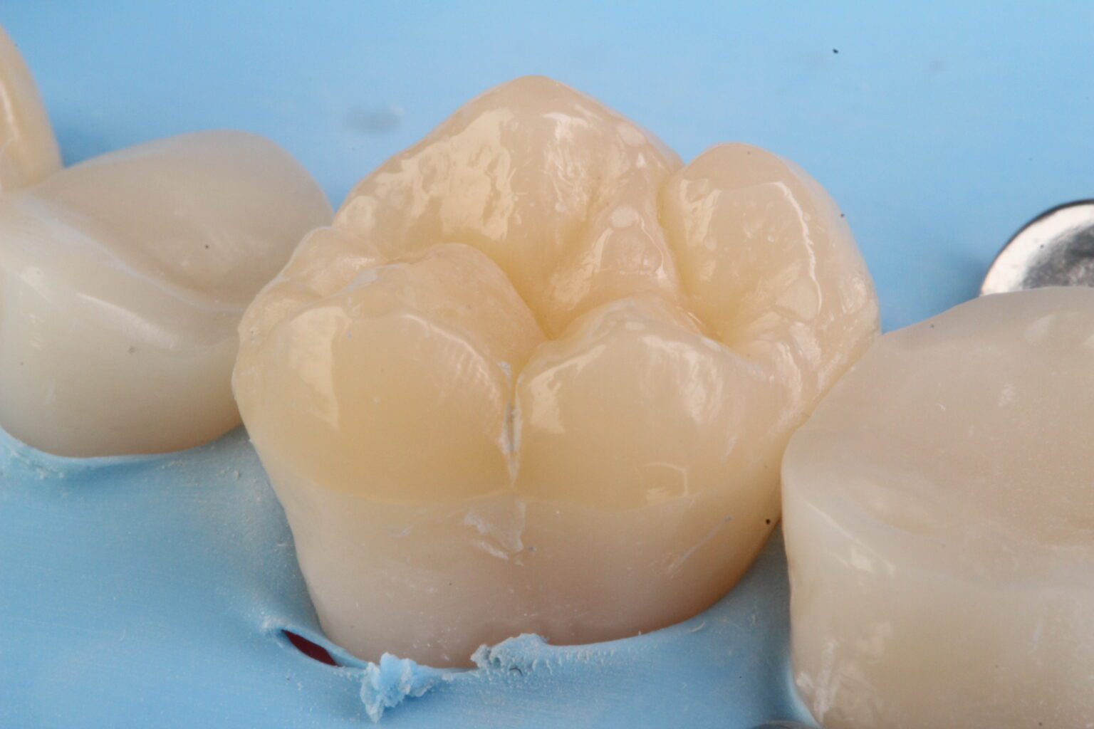 Course Contents 3 - Injectable Technique – Composite Tabletops in Distal Teeth by David Geštakovski